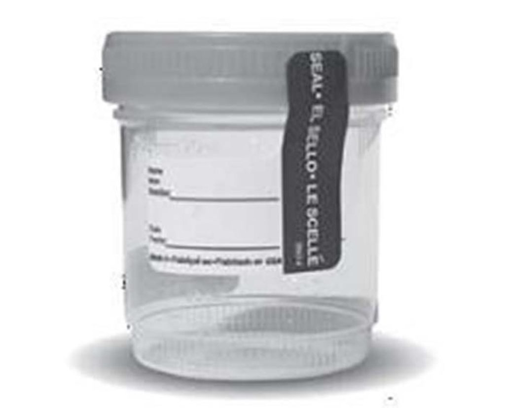 Alere Sterile Urine Specimen Collection Cups With Temperature Strips