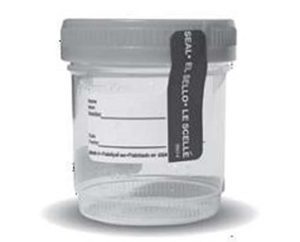 Alere Sterile Urine Specimen Collection Cups With Temperature Strips